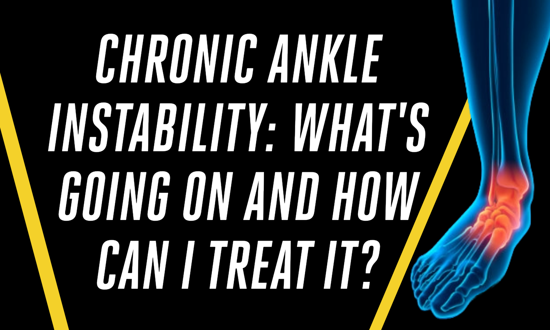 Chronic Ankle Instability: What's Going On and How Can I Treat It?