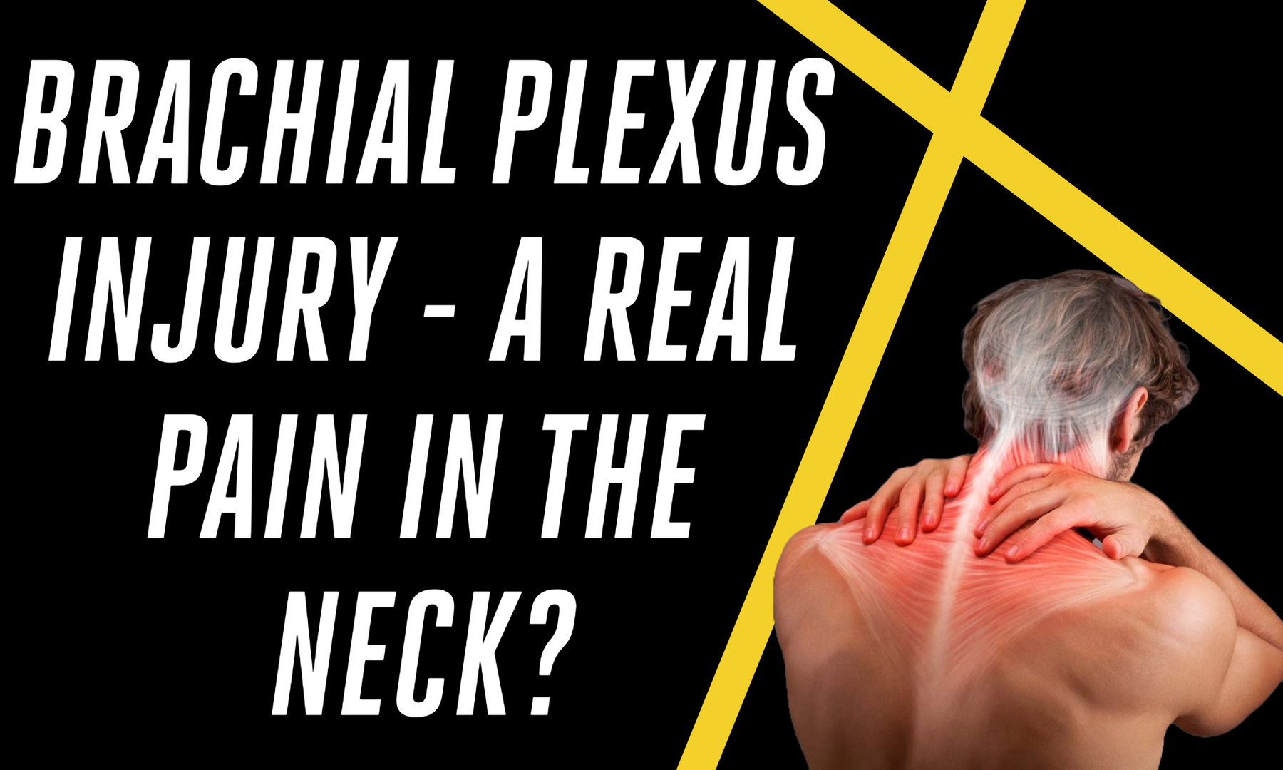 Brachial Plexus Injury - A Pain In The Neck?