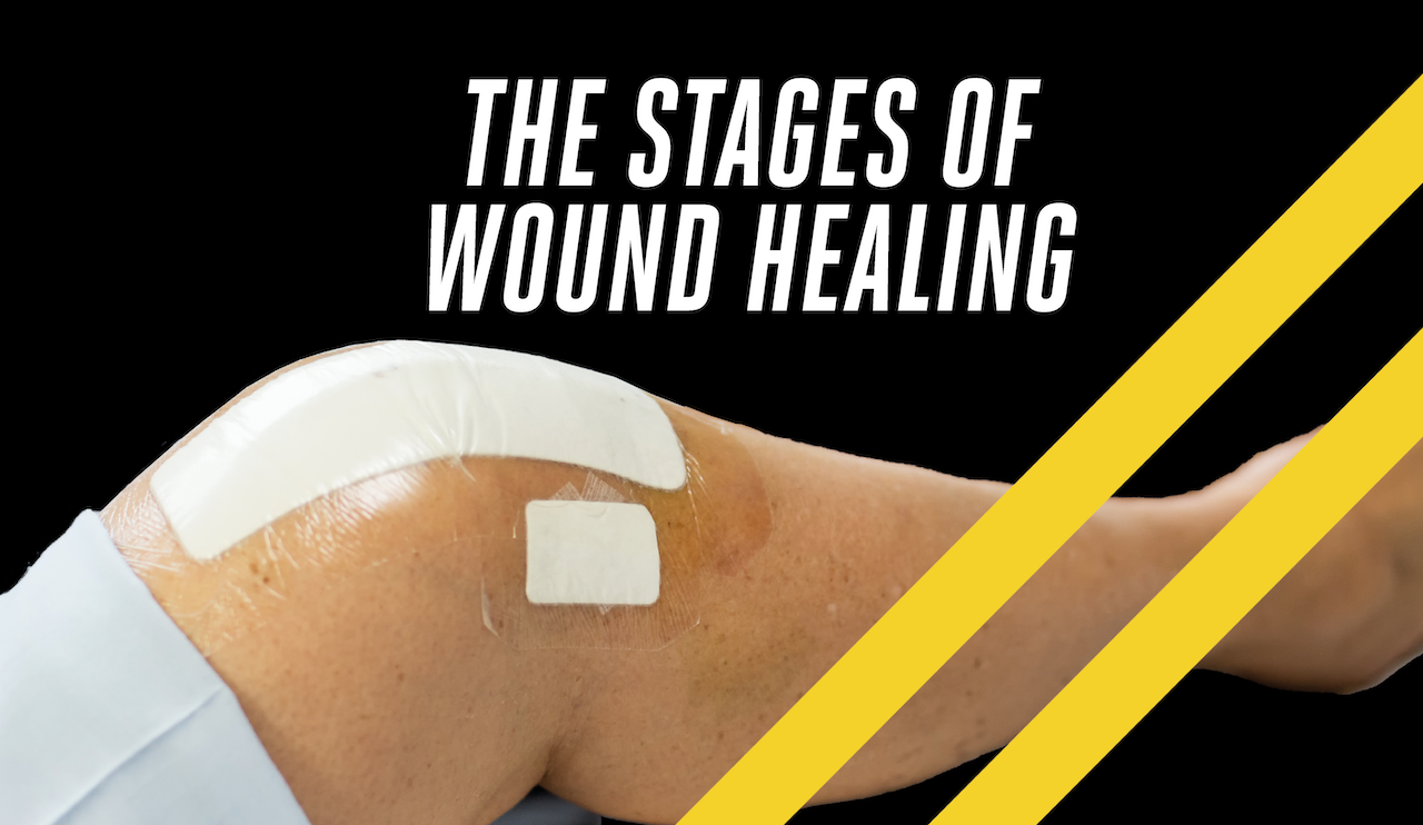 The Stages Of Wound Healing