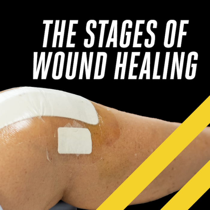 The Stages Of Wound Healing