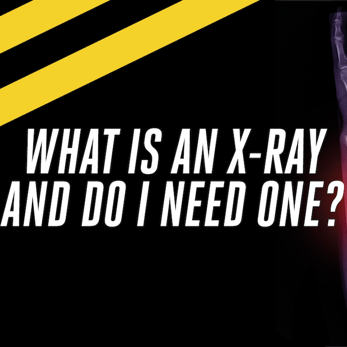 What Is An X-ray And Do I Need One?